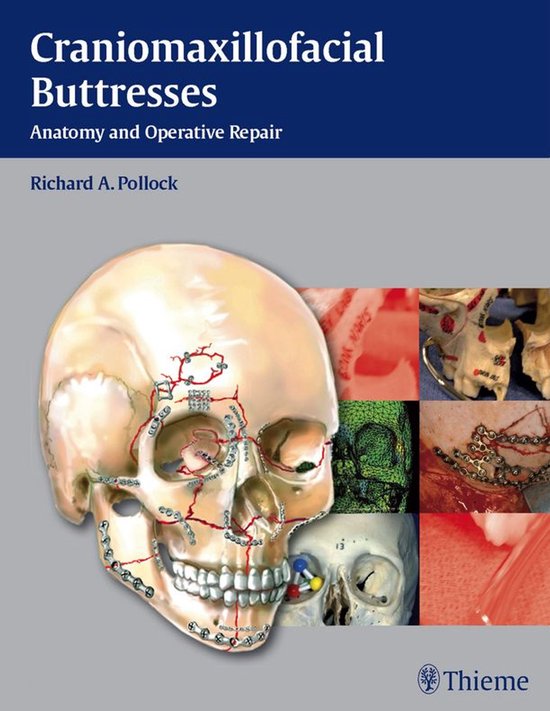 Craniomaxillofacial ButtressesEbook Anatomy and Operative Repair