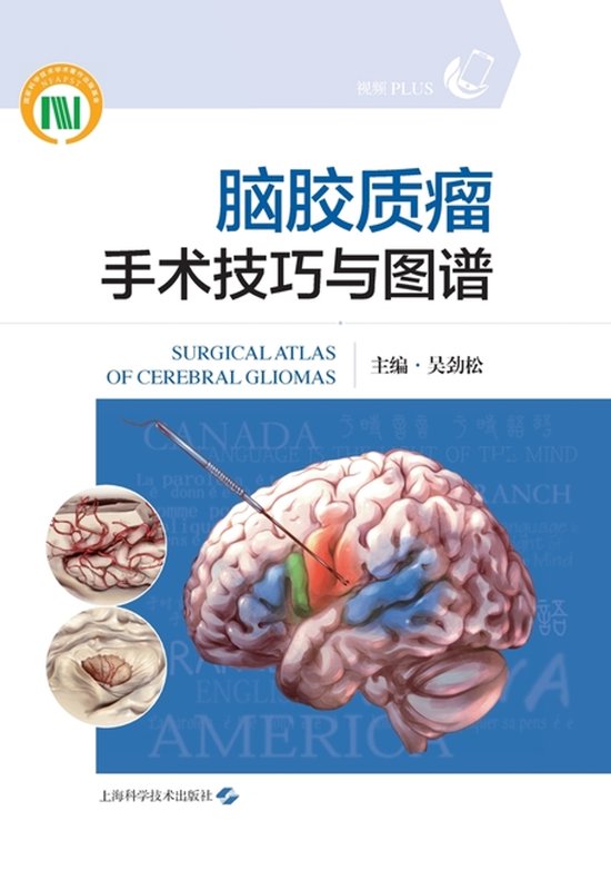 Surgical Techniques and Atlas of Brain Glioma Surgery/脑胶质瘤手术技巧与图谱 Surgical Techniques and Atlas of Brain Glioma Surgery/脑胶质瘤手术技巧与图谱